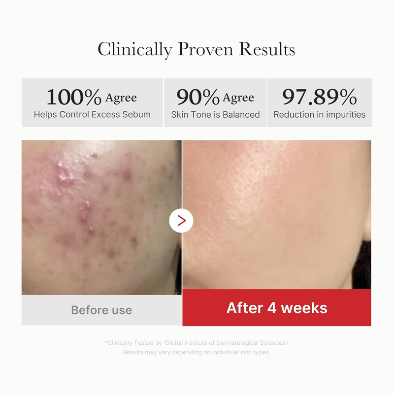 Red Succinic Acid Toner Pads AHA BHA Niacinamide Facial Peeling Pads 703