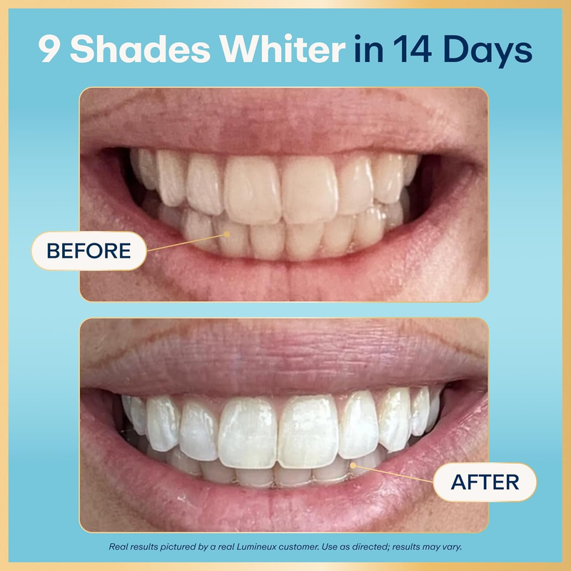 Teeth Whitening Duo Kit Peroxide Free 21 Treatments 2 Toothpaste1