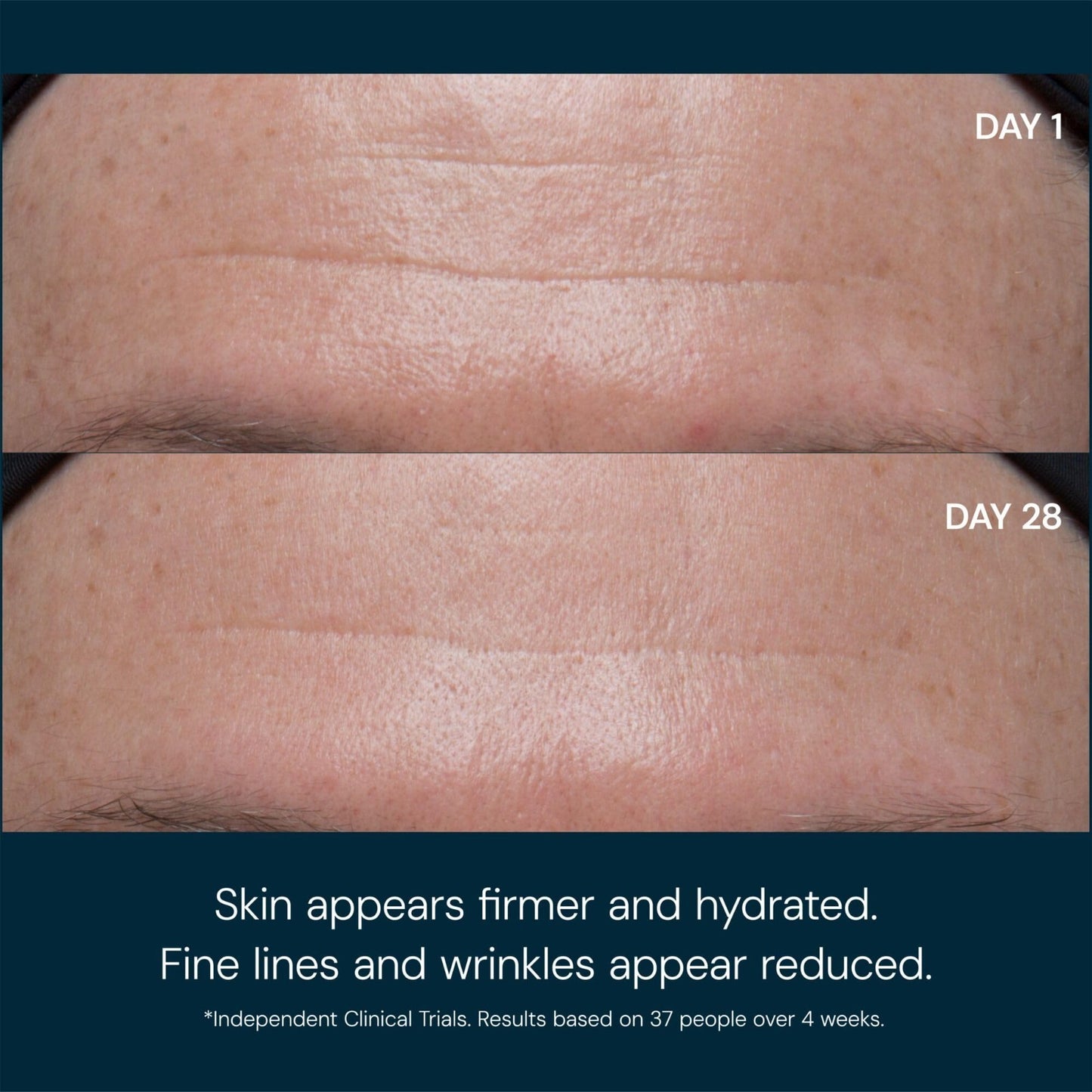 Lightweight Anti Wrinkle Facial Moisturizer with SPF 30   Pro Collagen Marine Cr2