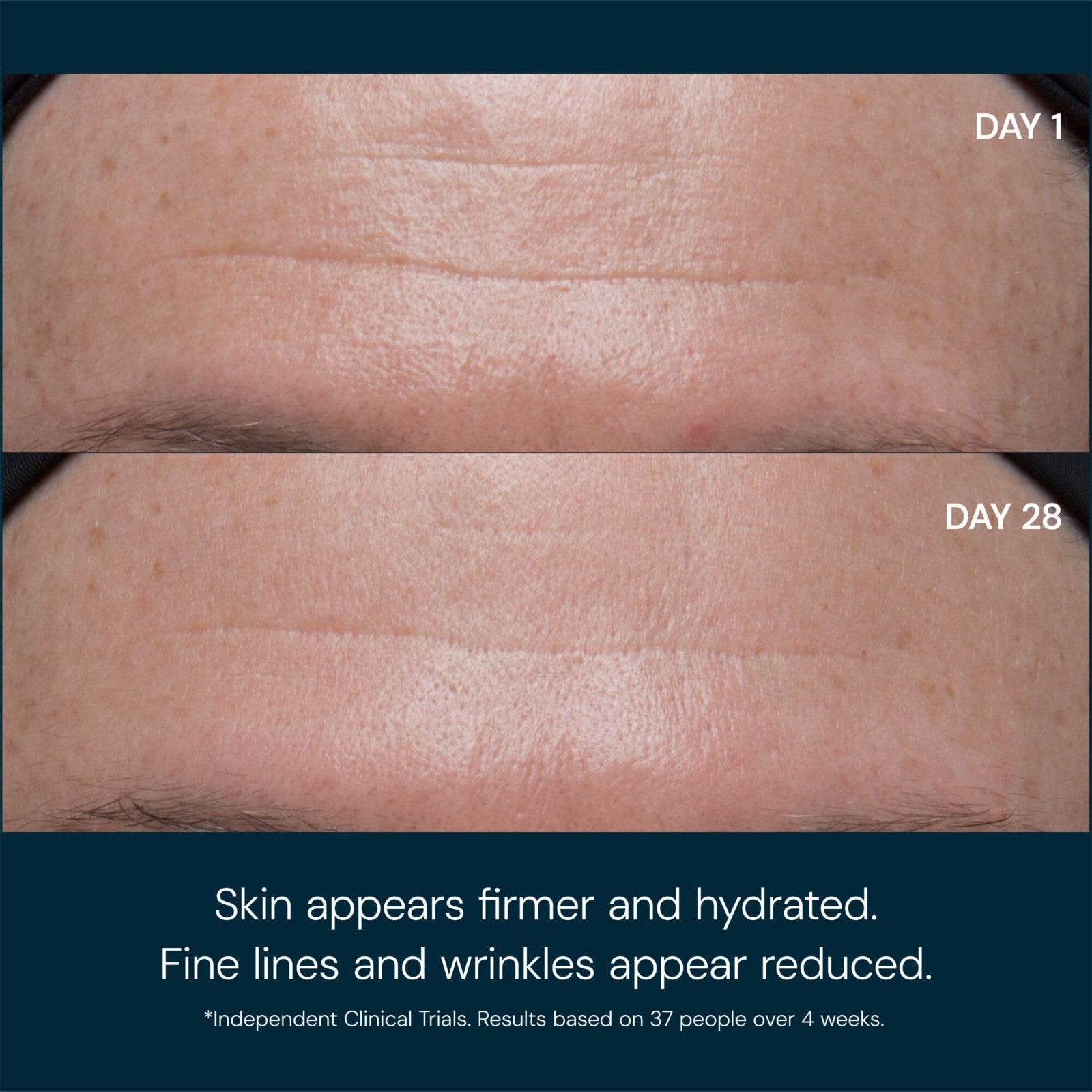 Anti Wrinkle Daily Facial Moisturizer SPF 30, Lightweight Pro Collagen Cream2