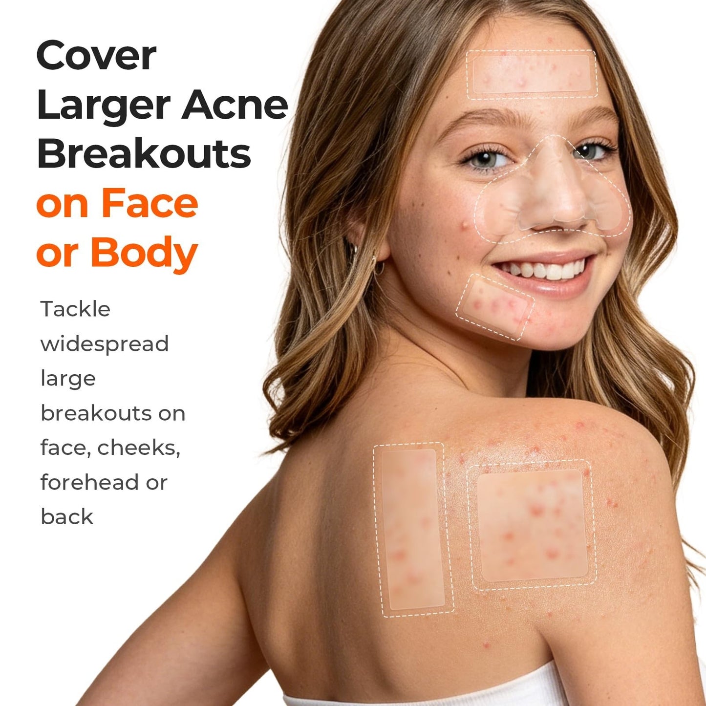 Large Hydrocolloid Pimple Patches for Acne Breakouts   4 Sizes, Fast Healing2