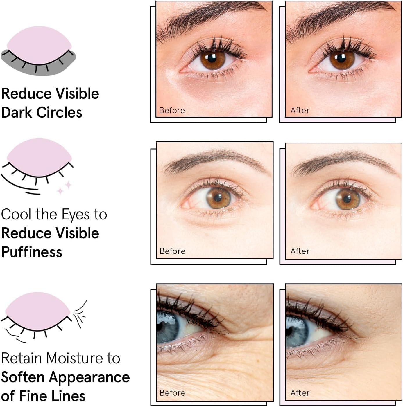Under Eye Masks - Reduce Dark Circles, Puffiness, Wrinkles - 72 Gel Patches, Veg6