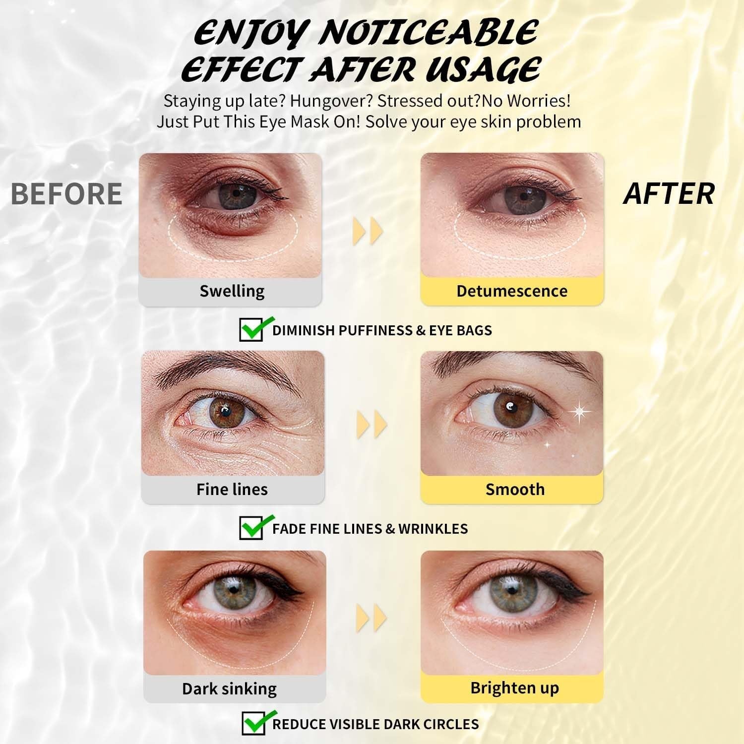Caffeine Under Eye Patches (30 Pairs) - Reduce Dark Circles, Puffiness & Wrinkle3