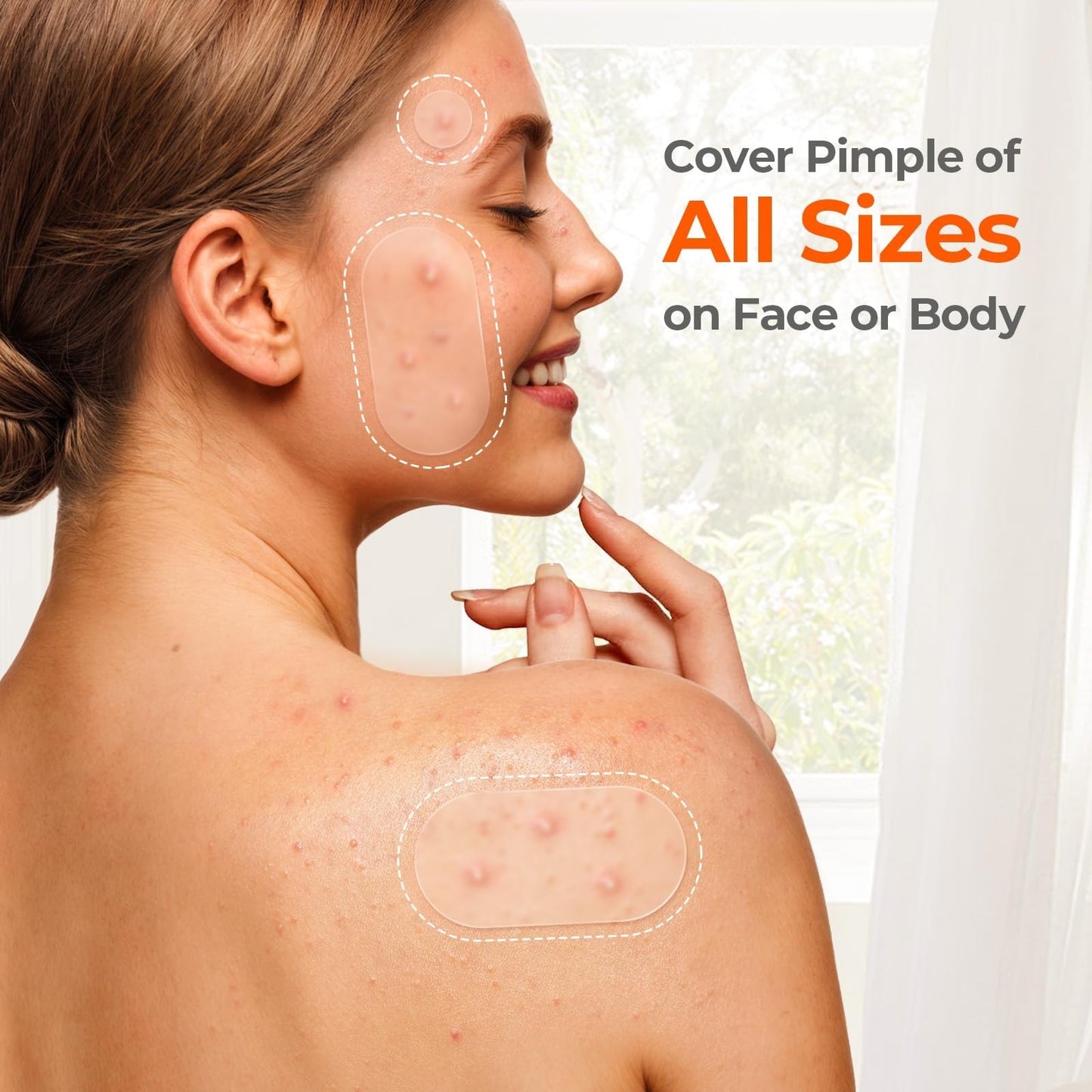 443 Count Hydrocolloid Pimple Patches for Face   Acne Treatment Cover Patch Bulk7
