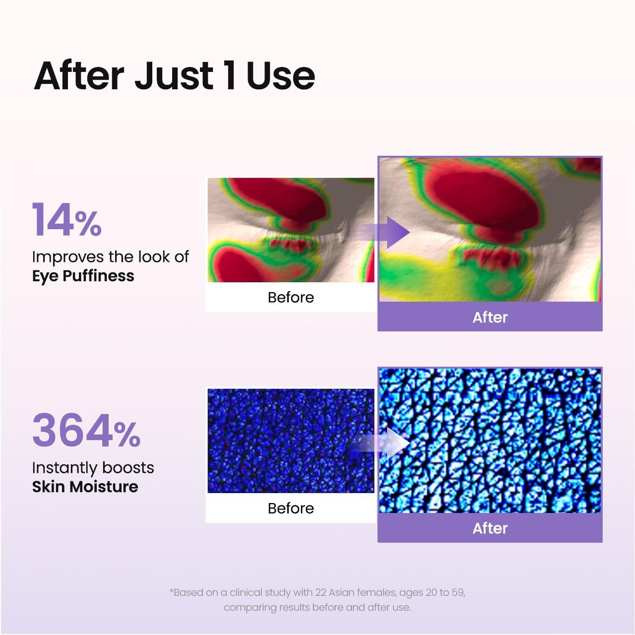 Nourishing Caviar Eye Patches for Dark Circles & Puffiness - 60 Count, Korean Sk4