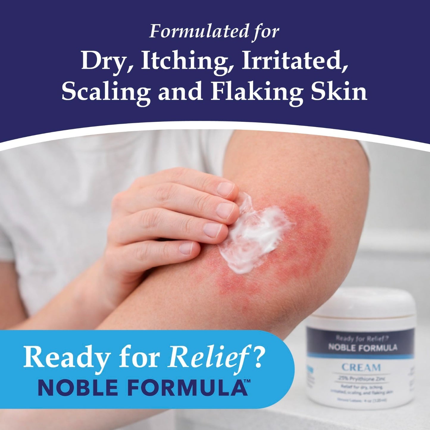 Pyrithione Zinc Cream 0.25% for Itchy Dry Skin, 4 oz | Rosehip Oil, Squalane, Vi2