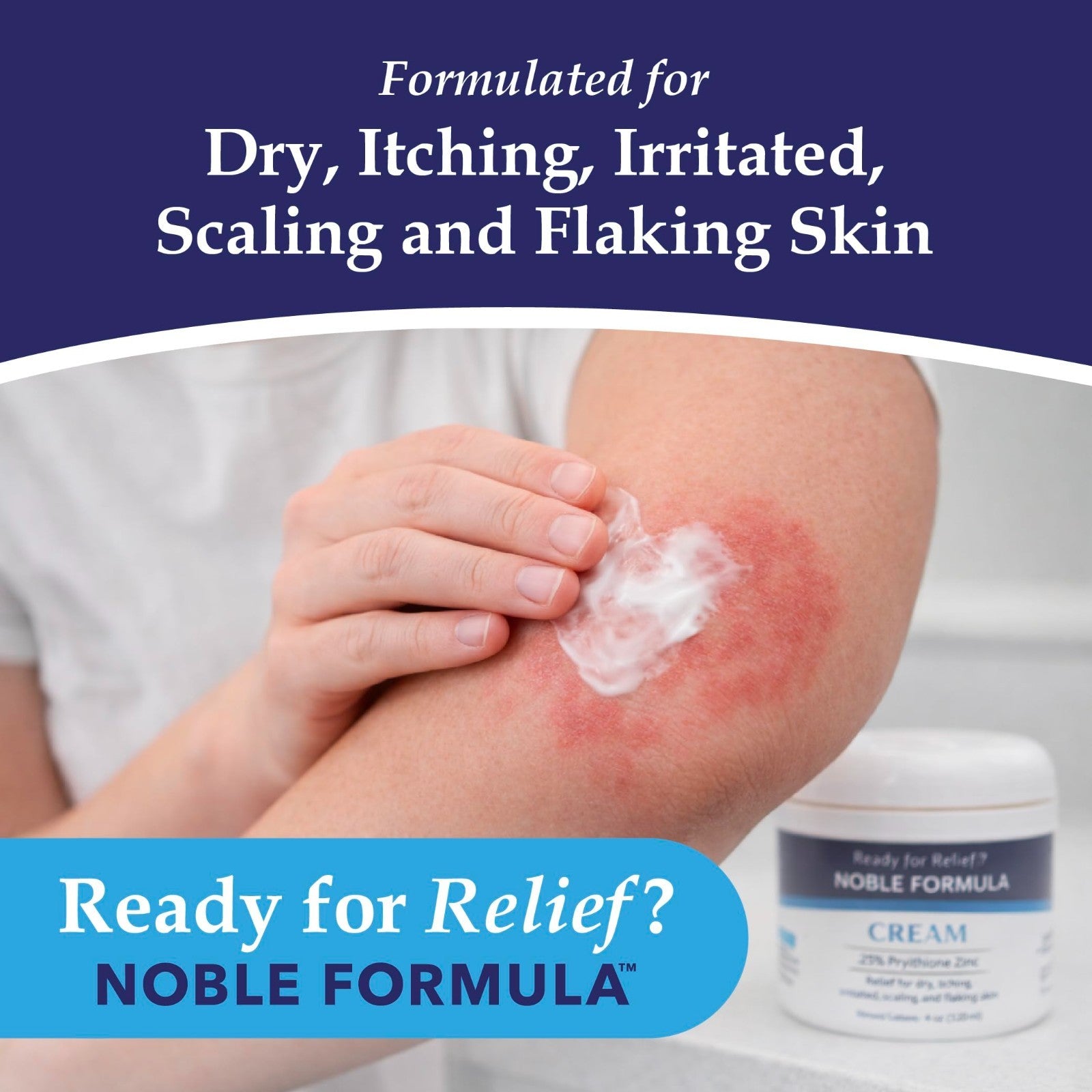 Pyrithione Zinc Cream 0.25% for Itchy Dry Skin, 4 oz | Rosehip Oil, Squalane, Vi2