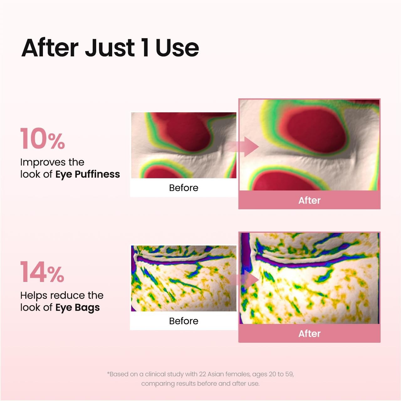 Collagen Peptide Eye Patches - Anti-Wrinkle, Under Eye Mask for Fine Lines & Bag13